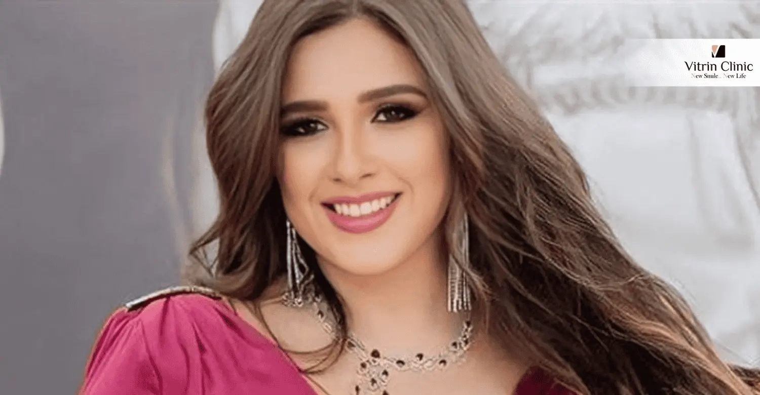 ابتسامة ياسمين عبد العزيز