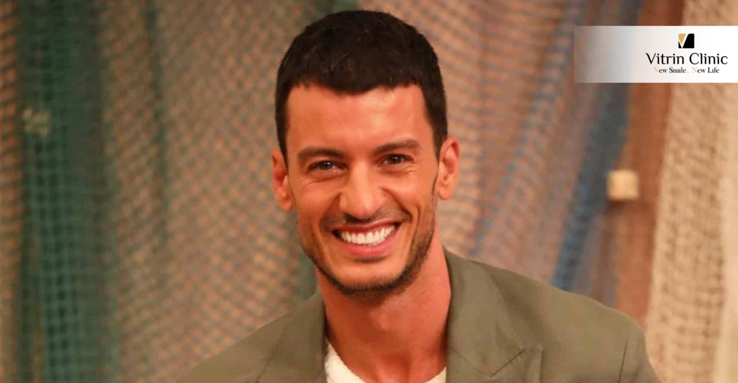 O Que Torna o Sorriso de Ruben Rua Único?