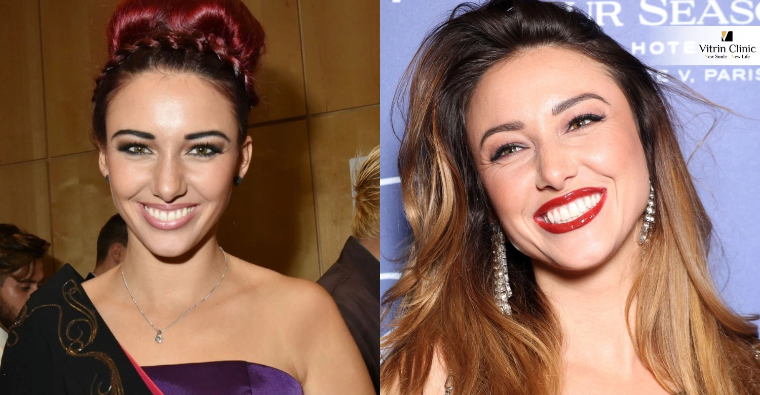 Les Soins Dentaires de Delphine Wespiser : L'Art d'Améliorer Sans Dominer