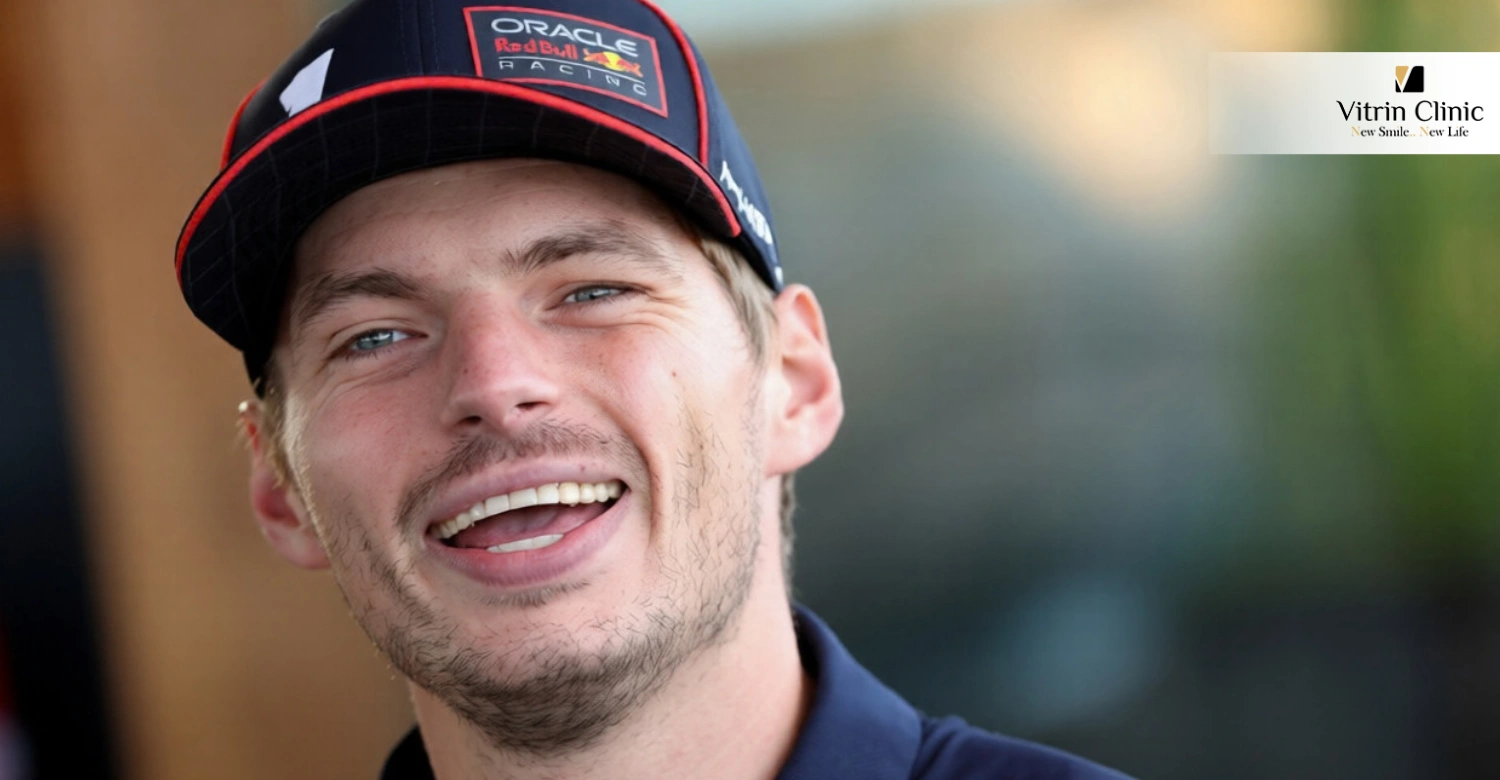 Улыбка Макса Ферстаппена