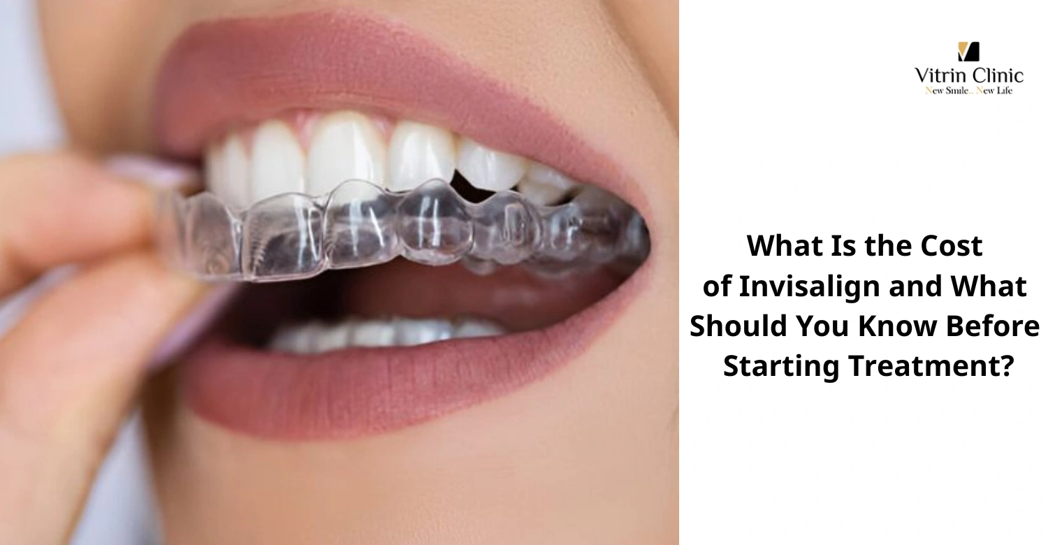 Premium Invisalign Cost & Package Details - Vitrin Clinic
