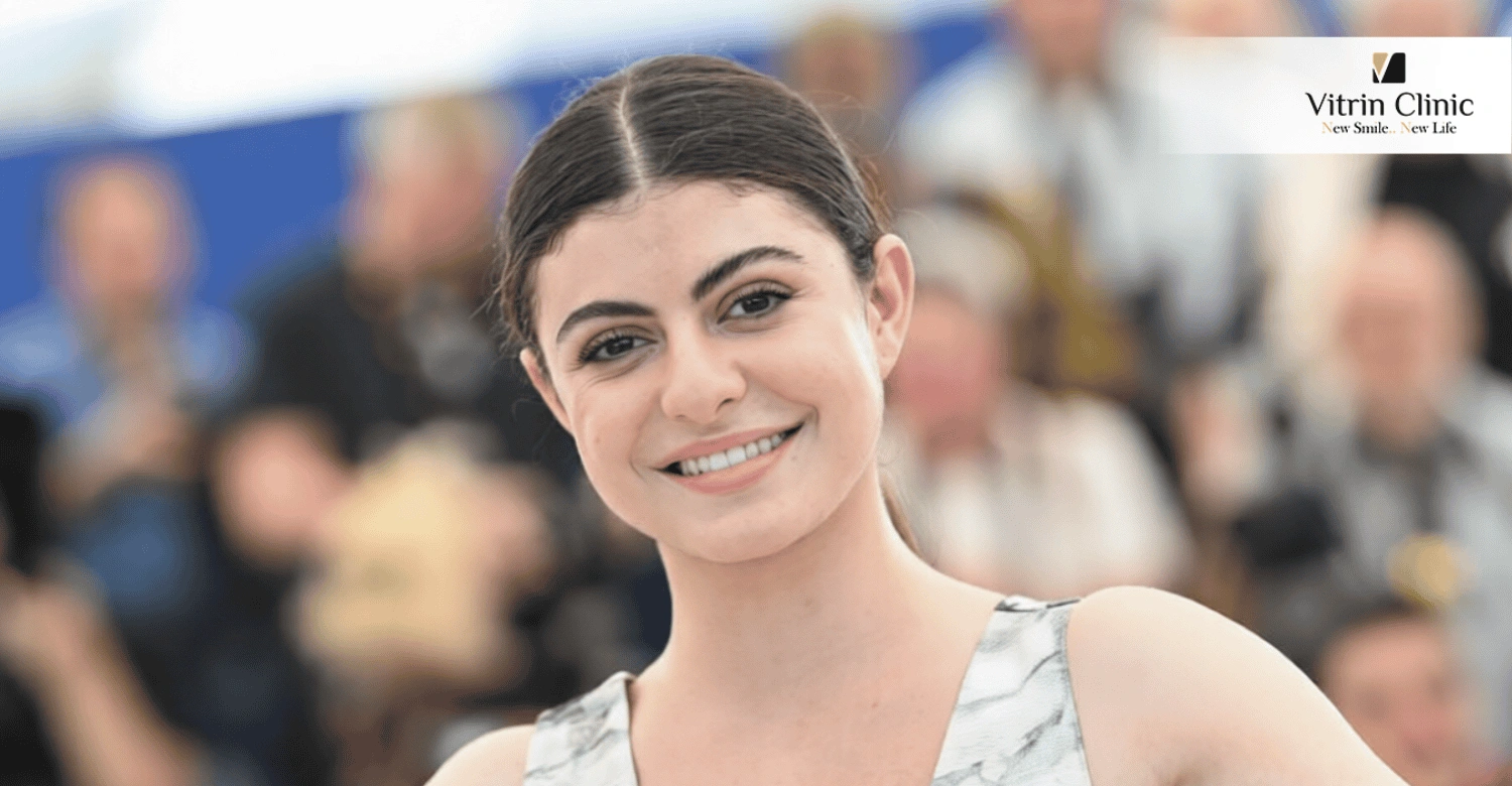 تحليل ابتسامة تارا عبود قبل وبعد