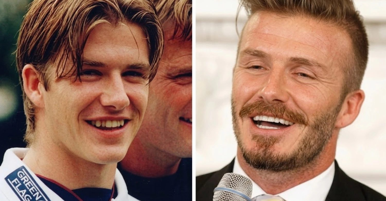 David Beckham before and after