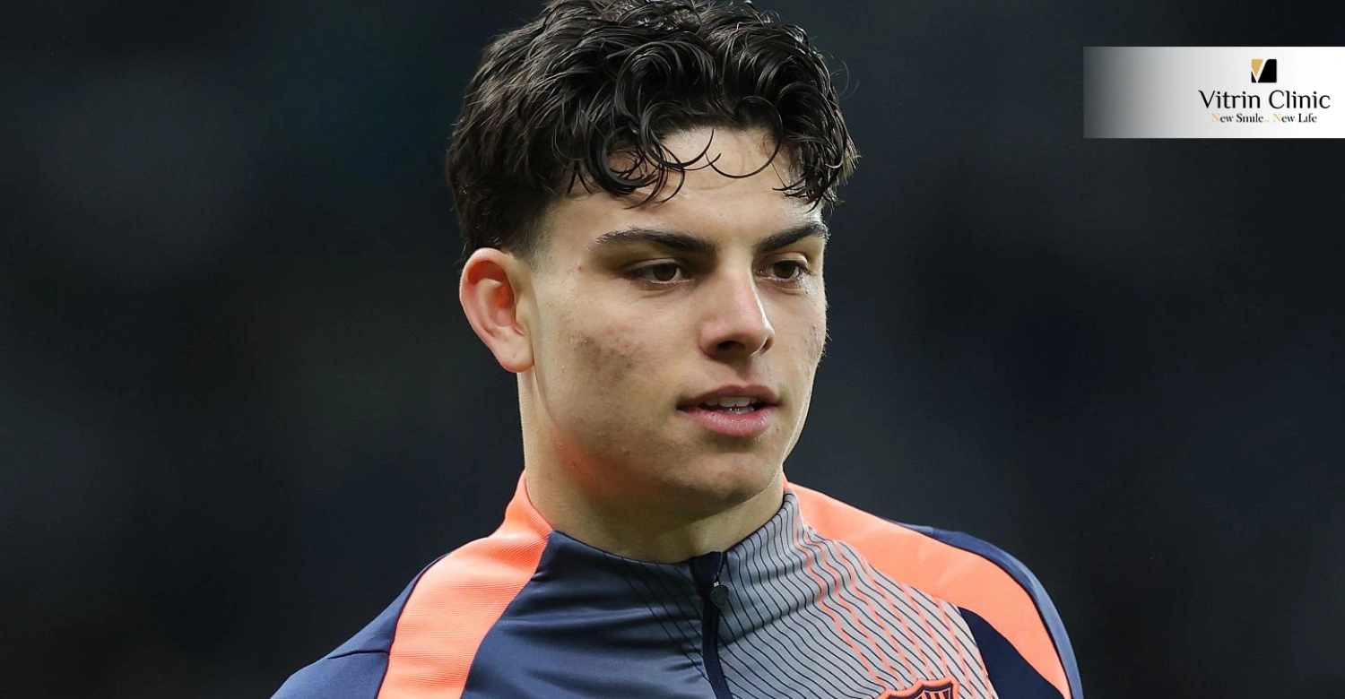  Улыбка Хави Эспарта