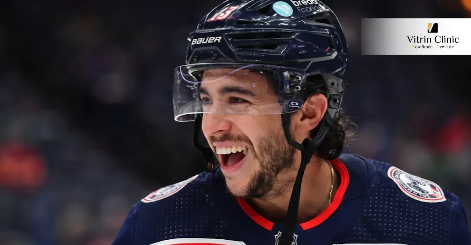 Johnny Gaudreau Zähne : Natürlich und Perfekt