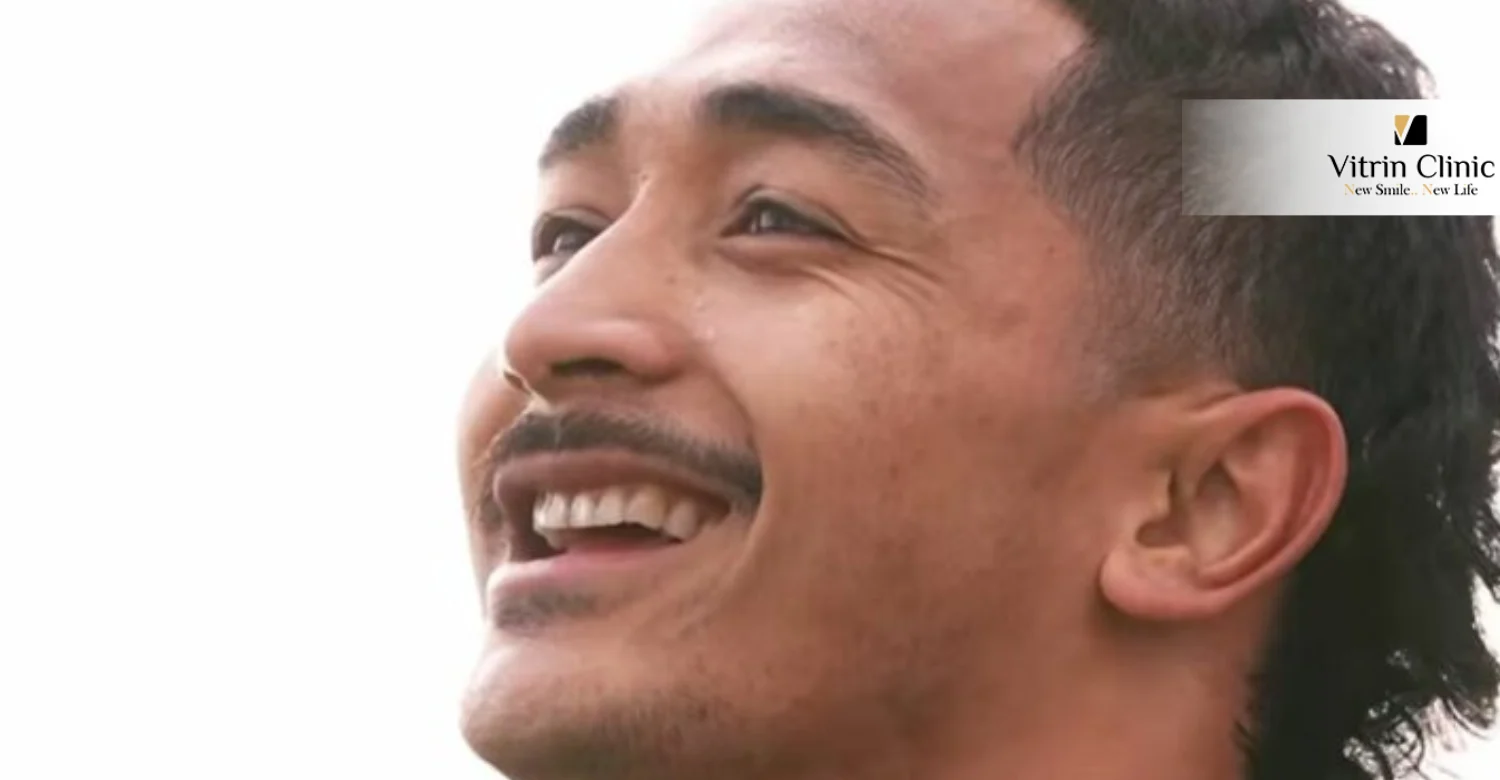 Le Souri­r de Yoram Moefana