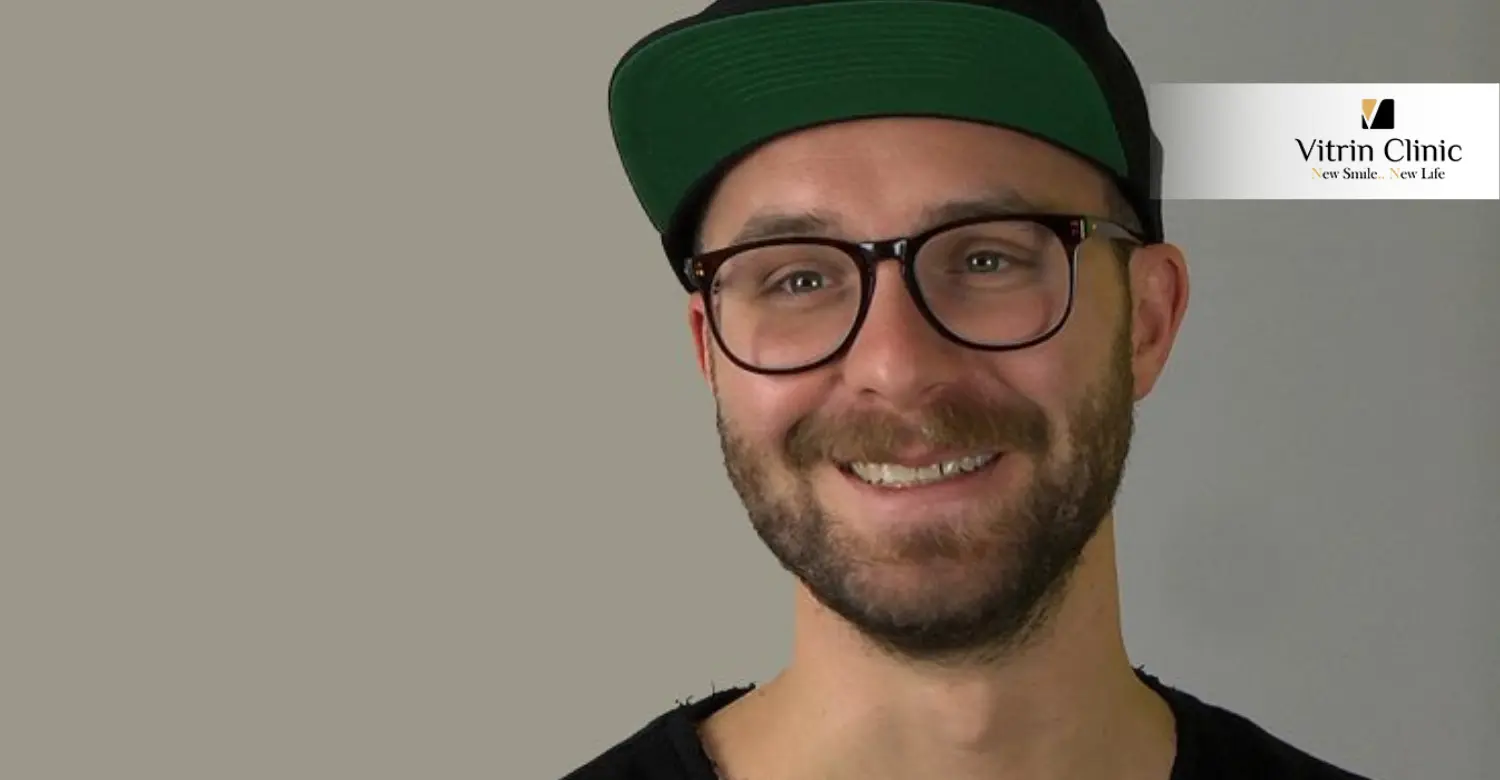 Ungezwungenes Proben Lächeln von Mark Forster