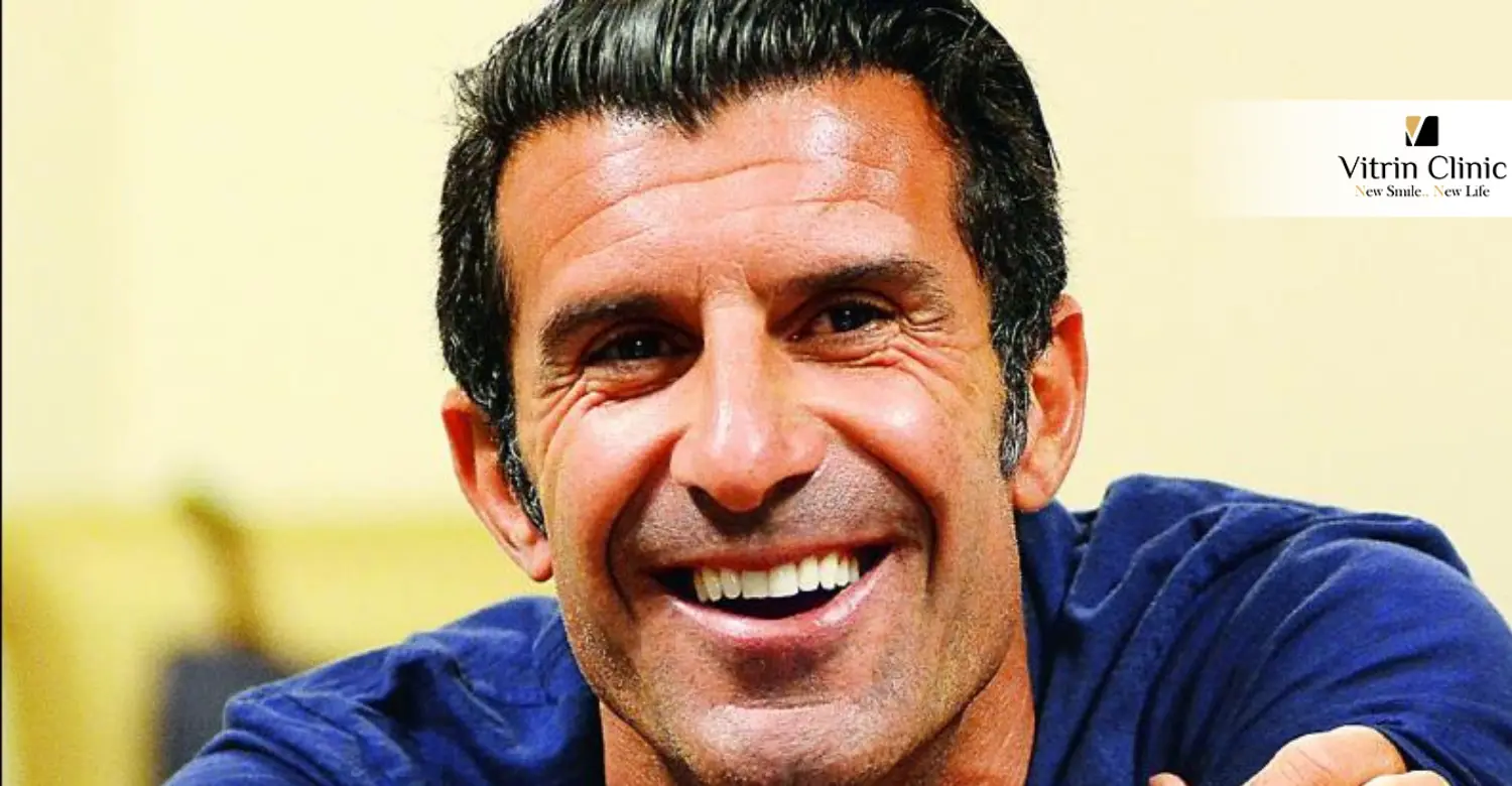 Dentes antes e depois