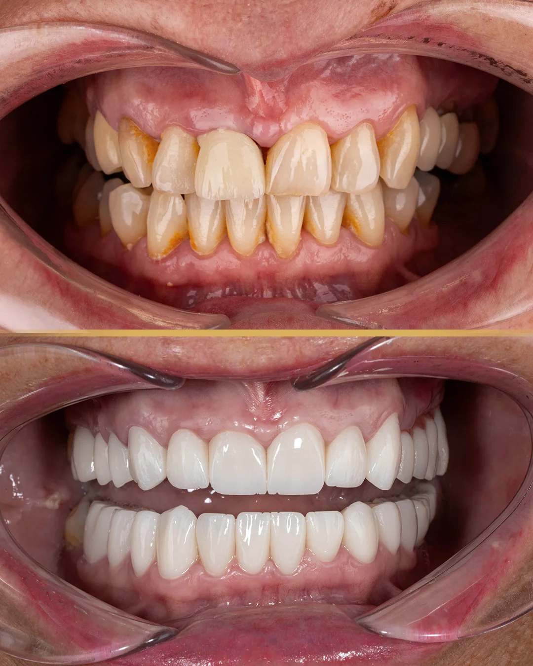 Radiografia dentale: a cosa serve e ogni quanto è necessaria?