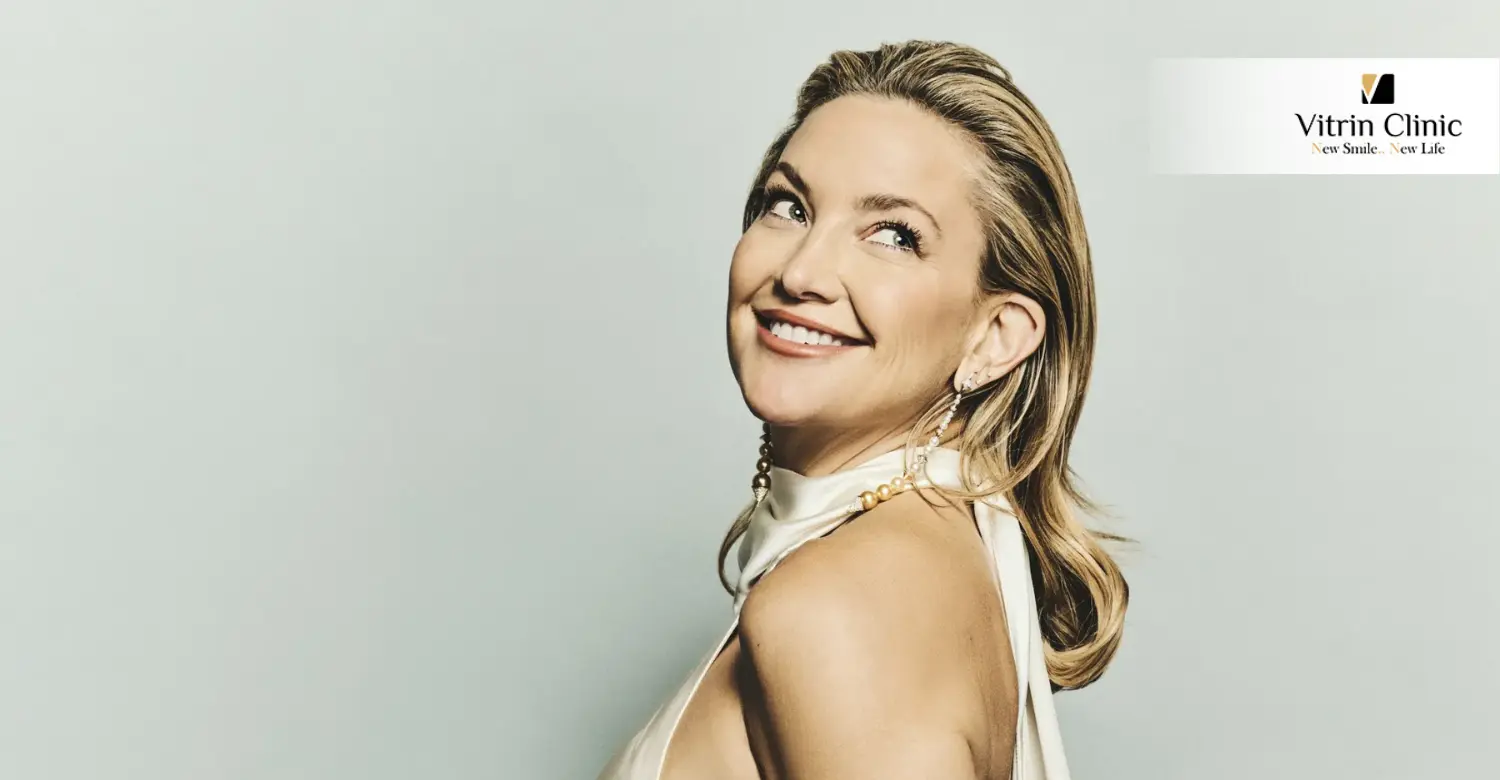 Путь Кейт Хадсон к отбеливанию зубов