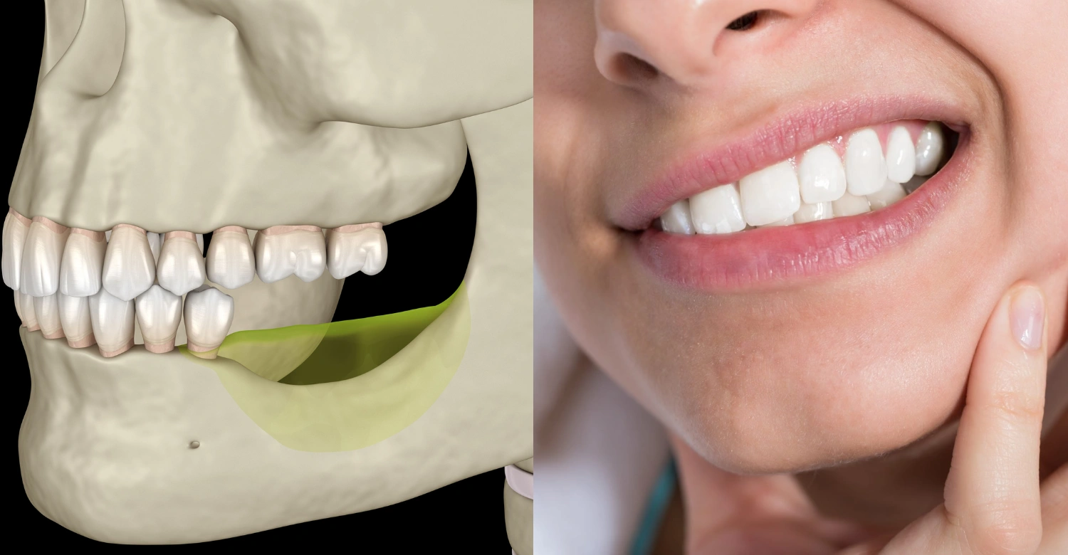 Bone Diseases in Mouth