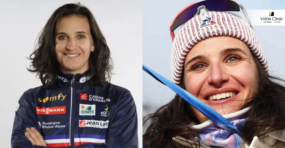 Avant et Après : Analyse du Sourire de Julia Simon