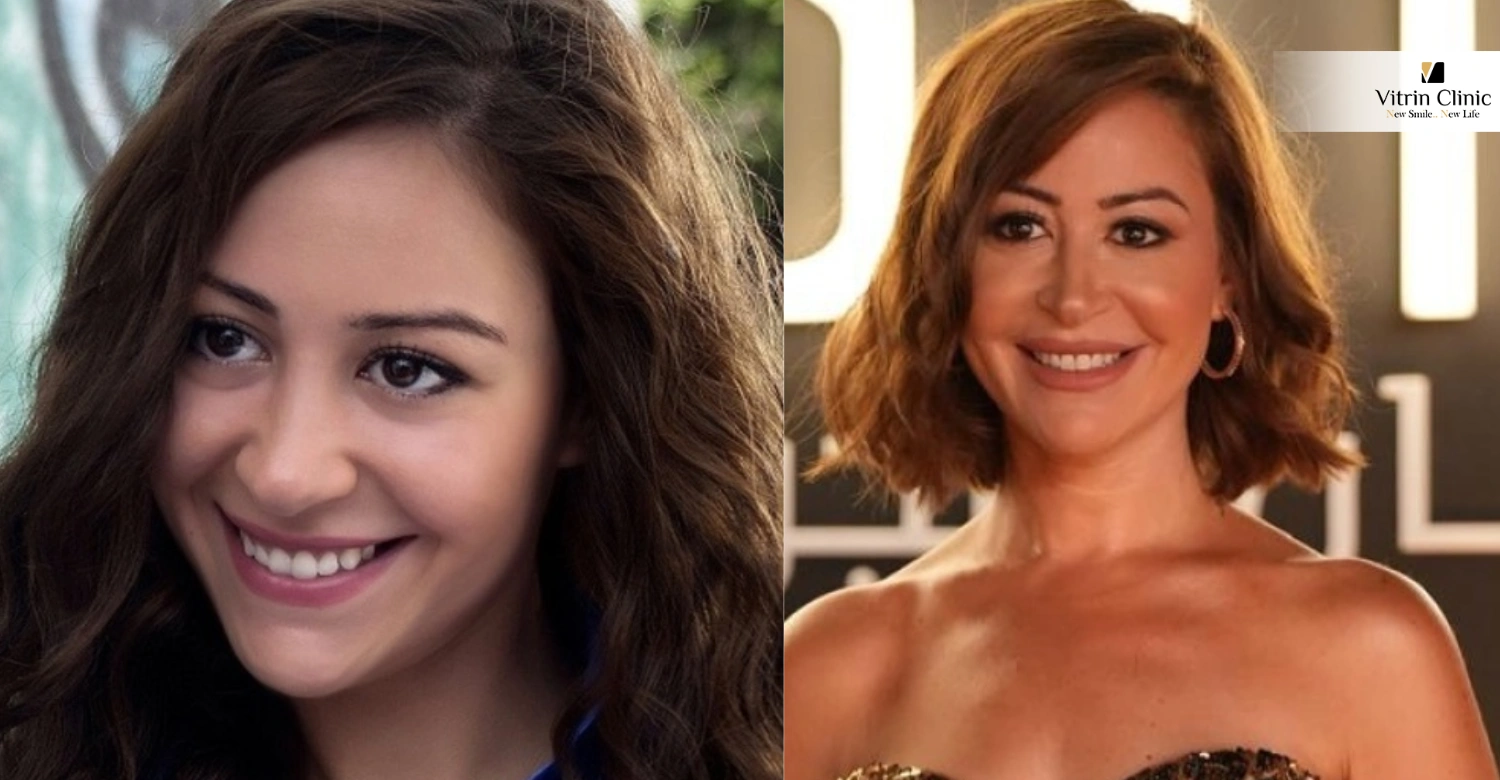 تطور ابتسامة منة شلبي عبر السنين