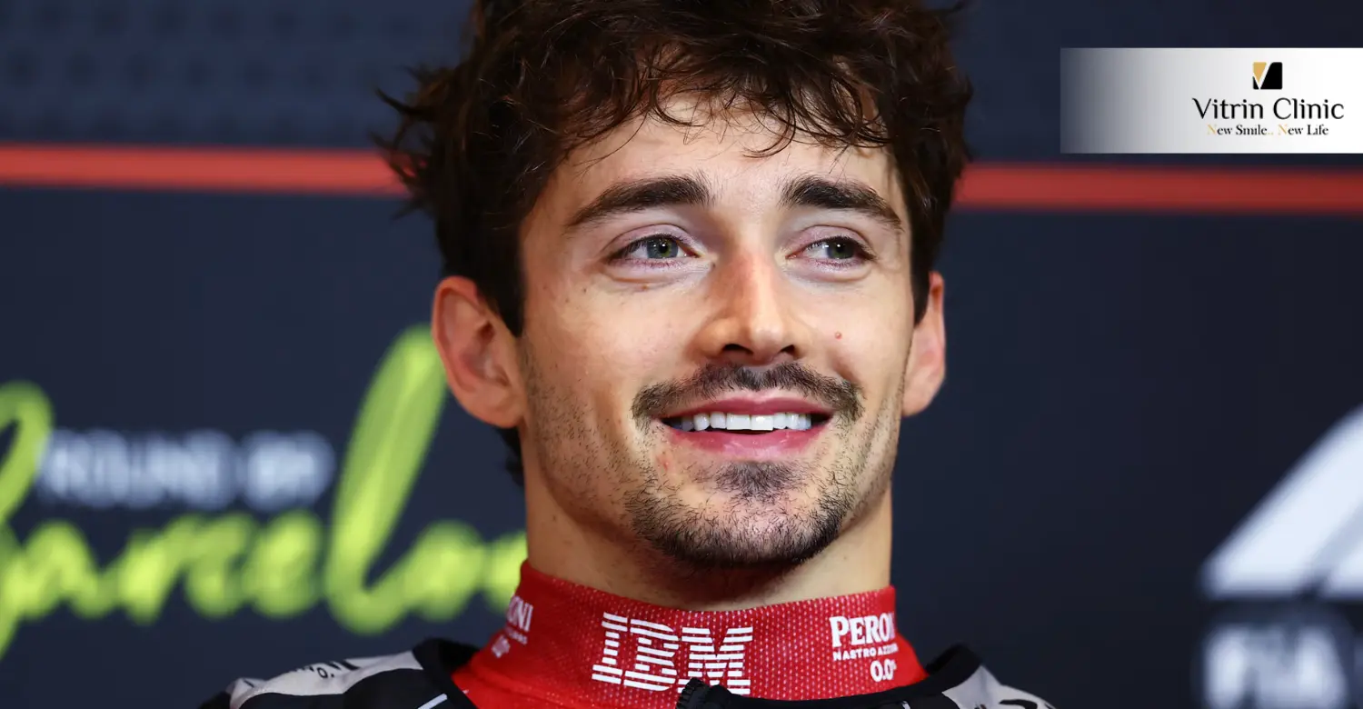 Denti di Charles Leclerc: Cosa Notano Prima i Fan