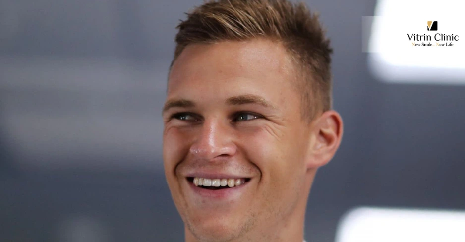 Joshua Kimmich Lächeltransformation: Von gewöhnlich zu bemerkenswert