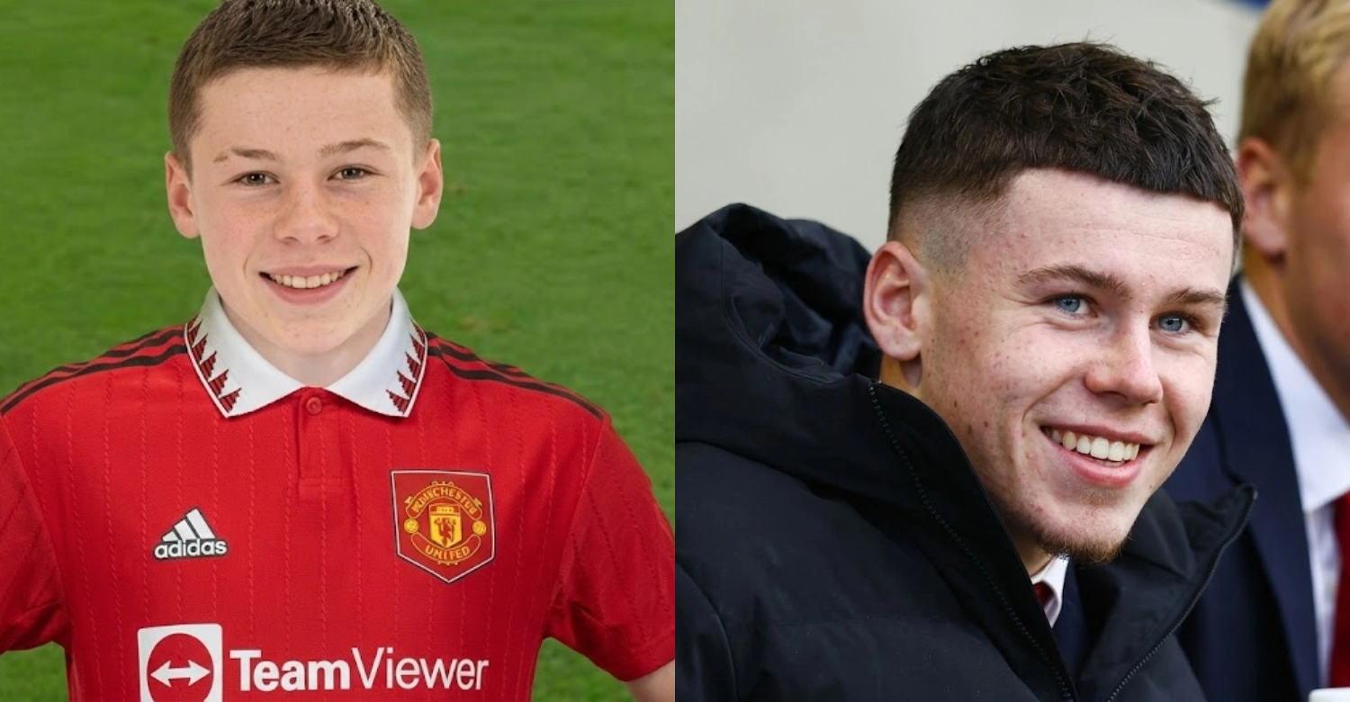 Kai Wayne Rooney Teeth 1