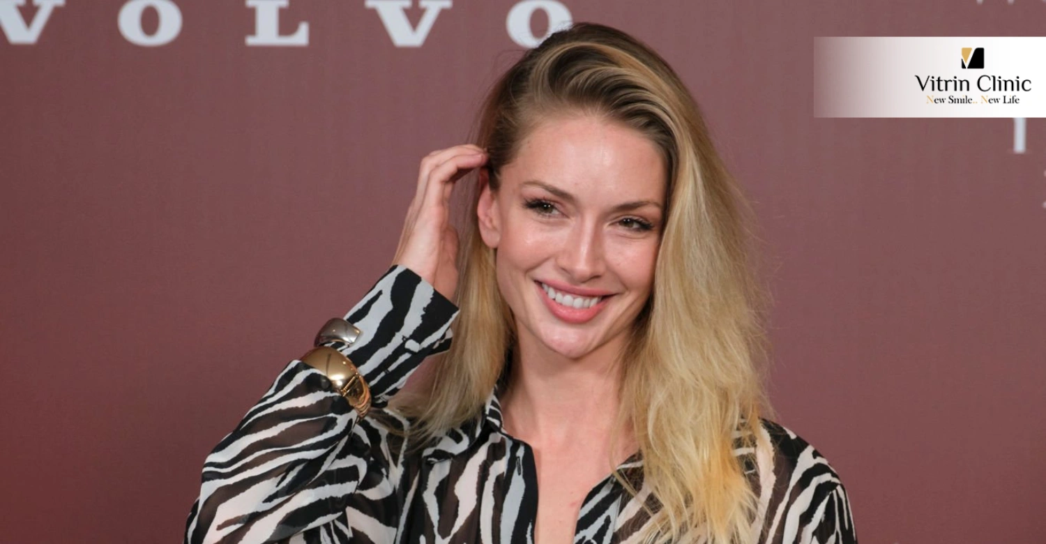 Yasemin Allen'ın Diş Yenileme Yolculuğunu Anlamak