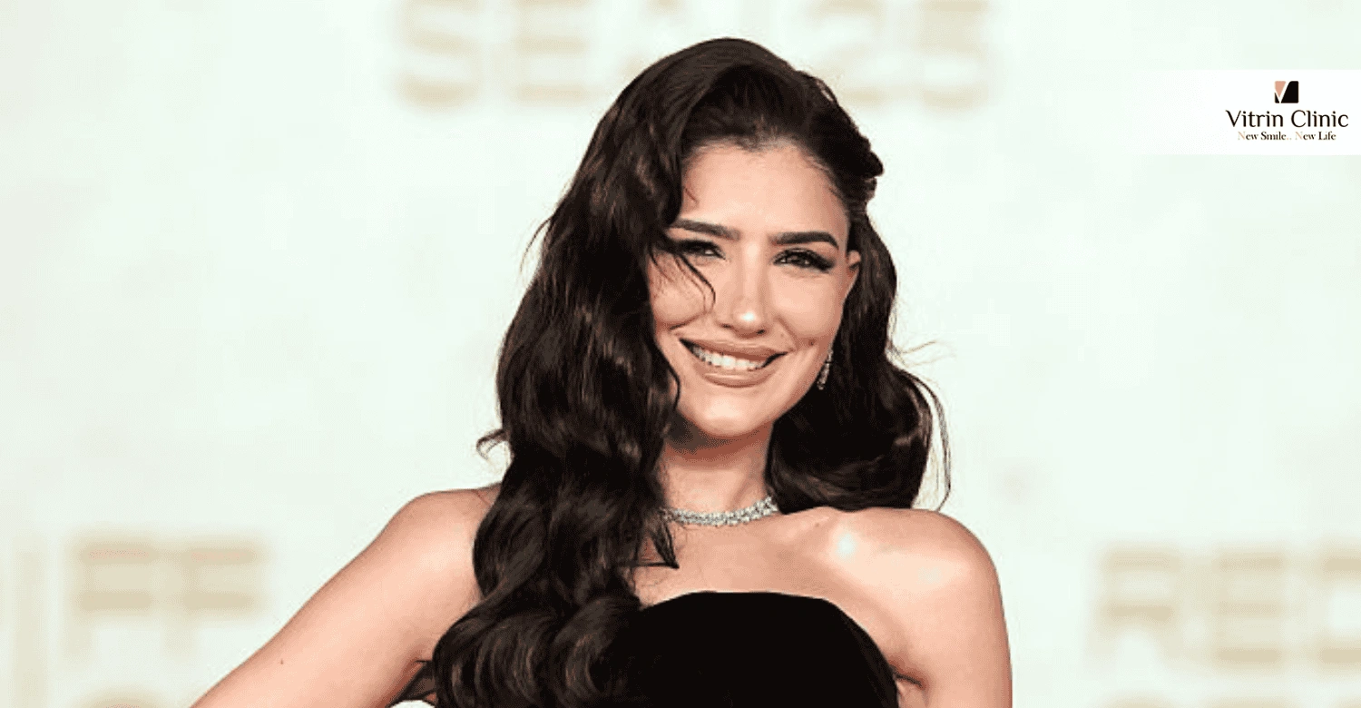 خطوات الحصول على ابتسامة مي عمر