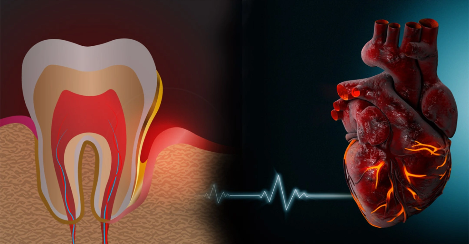 Are Root Canals Bad for Your Heart? - Vitrin Clinic