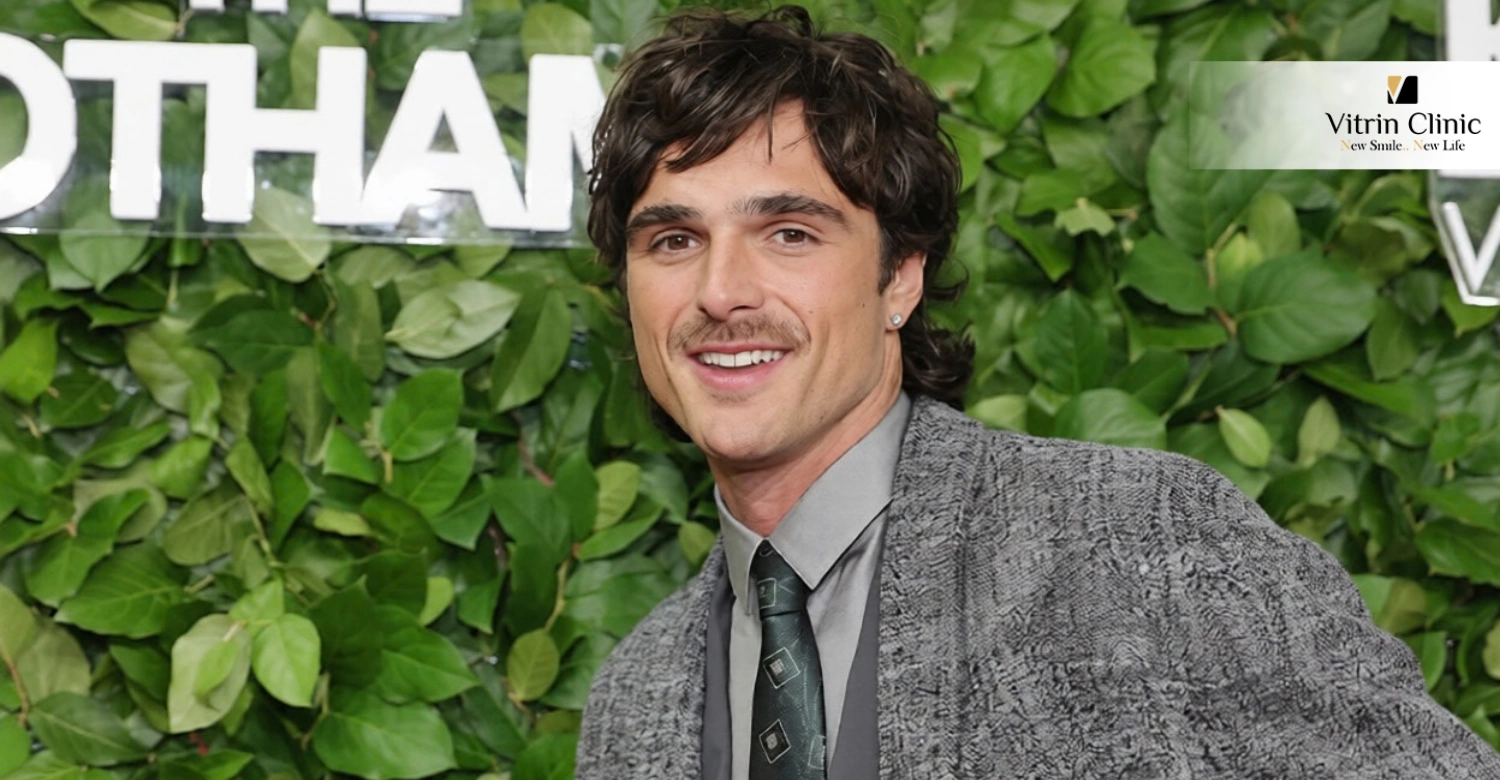 Transformación y estética dental de Jacob Elordi