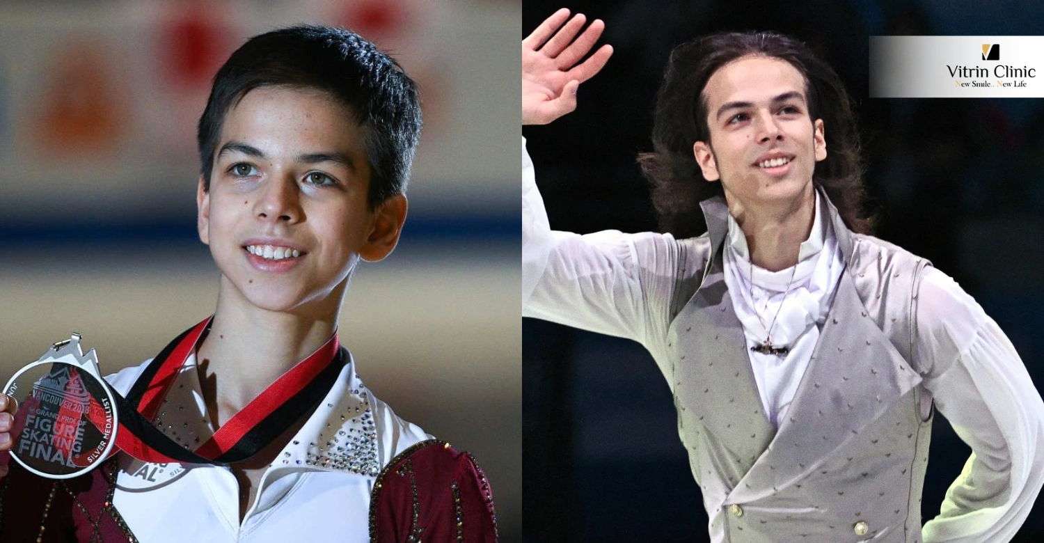 Улыбка Петра Гуменника
