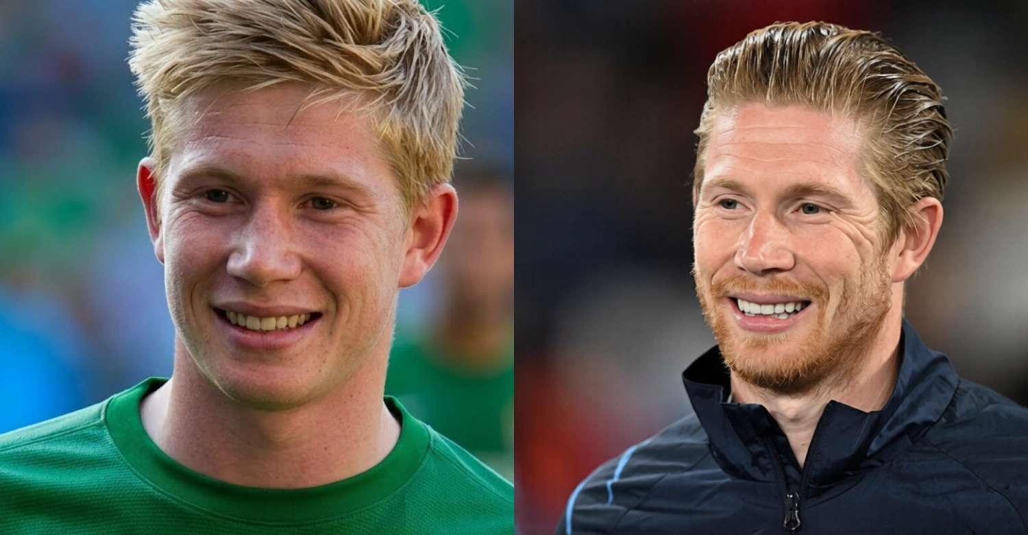 Kevin De Bruyne Teeth 1