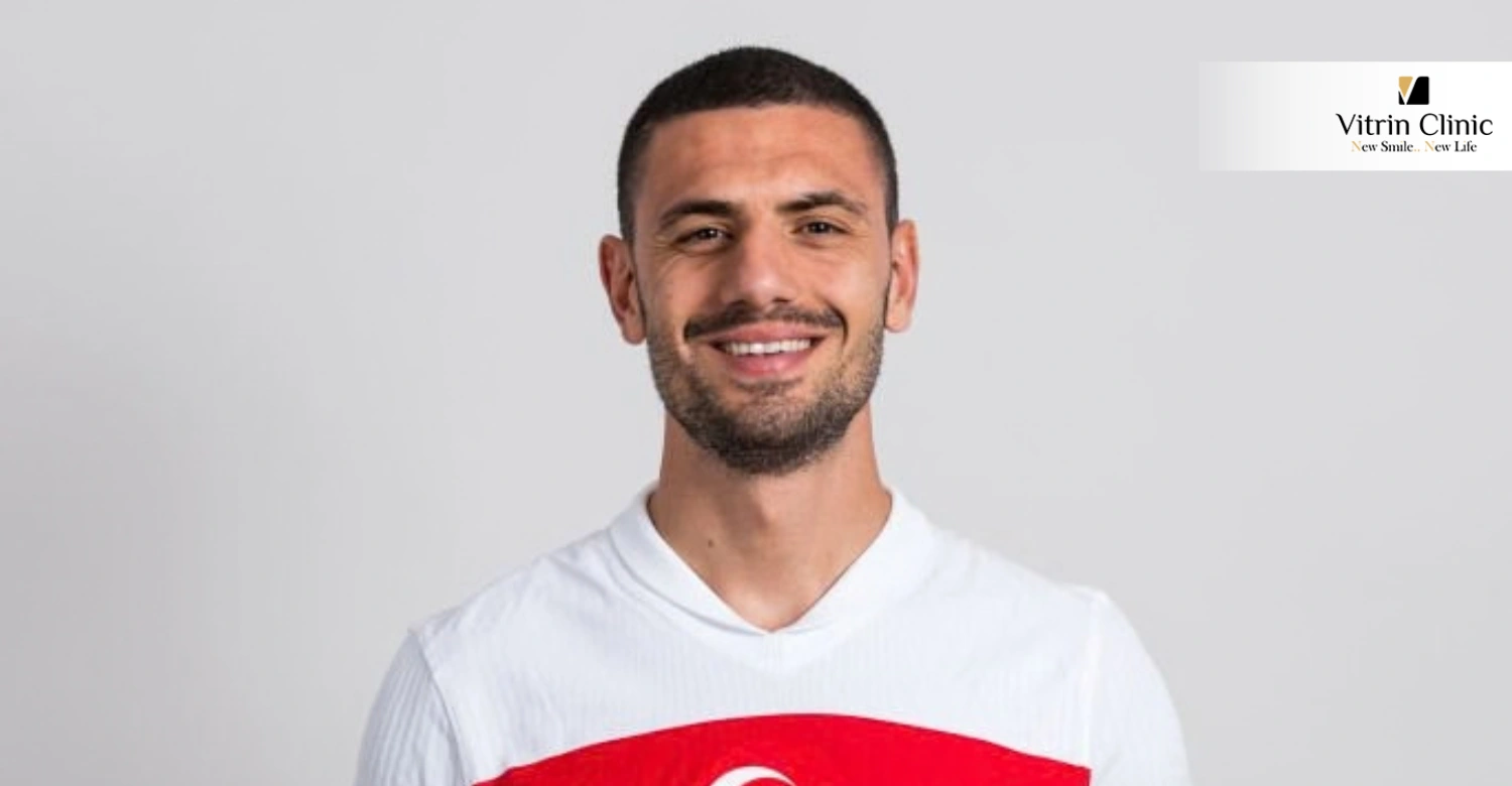 Merih Demiral Gülüşü