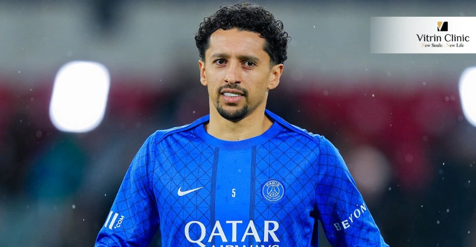 Leçons de Marquinhos pour Ceux qui Envisagent la Dentisterie Esthétique