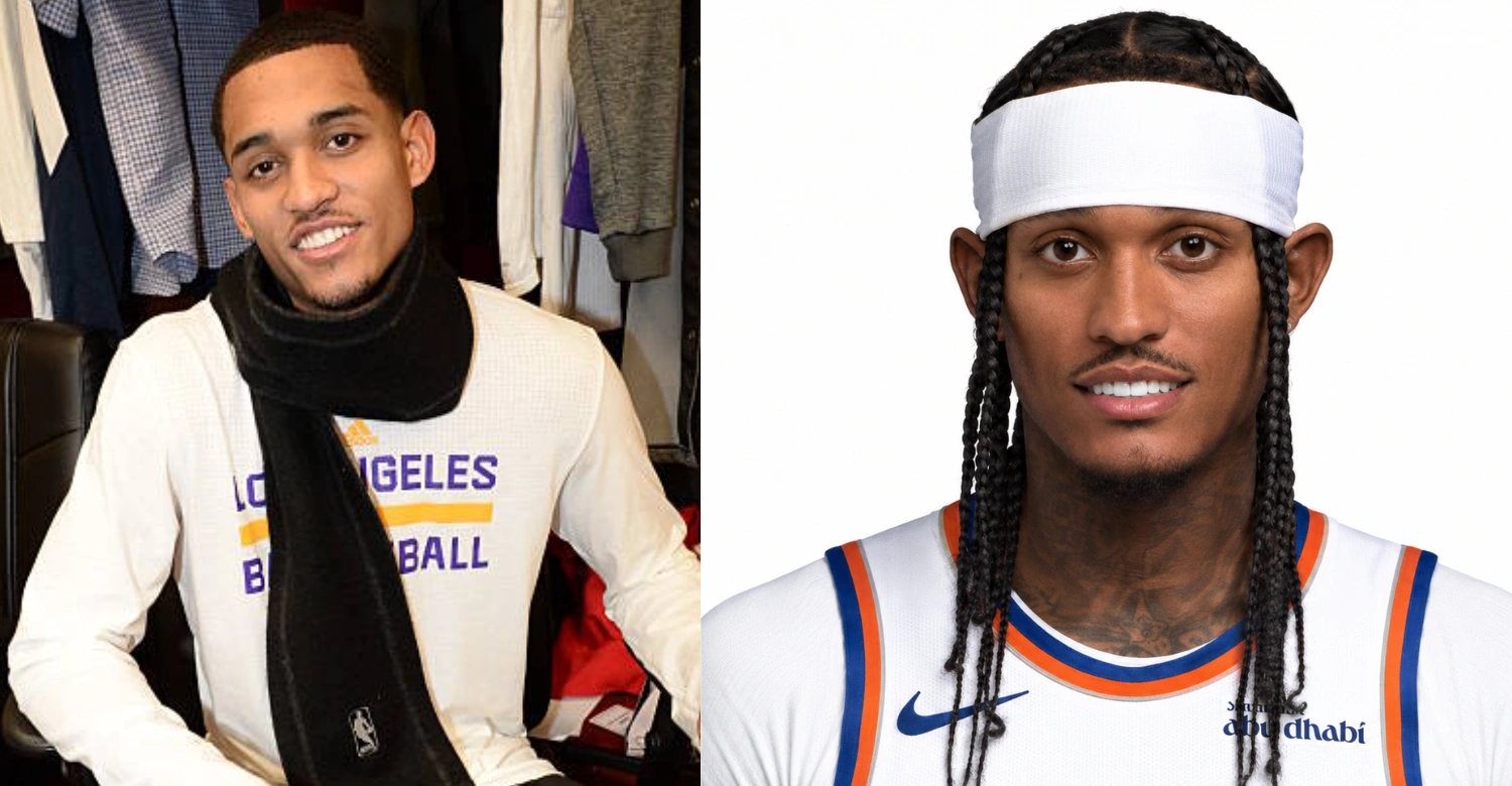 jordan clarkson Teeth 1