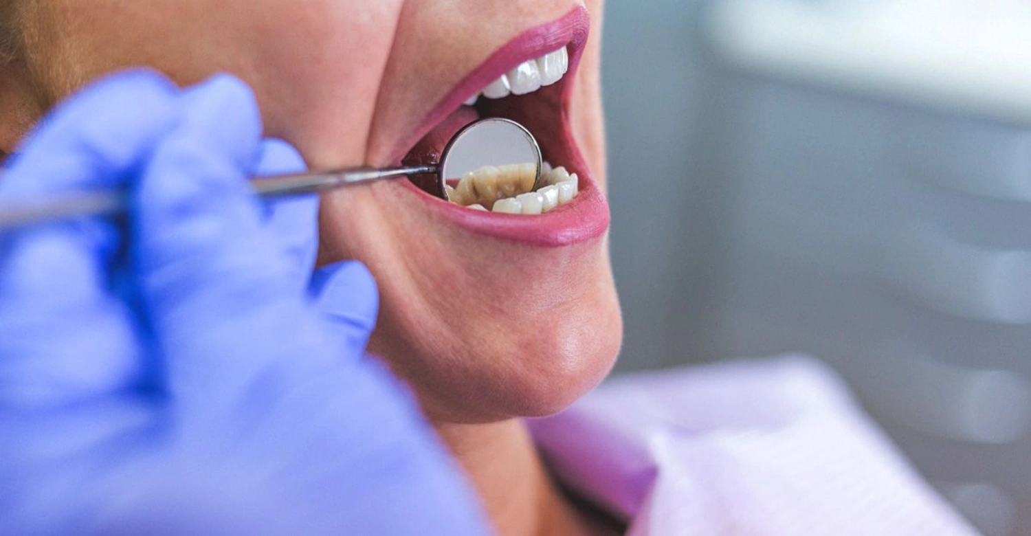 Different Types of Tooth Pain and Their Causes - Vitrin Clinic