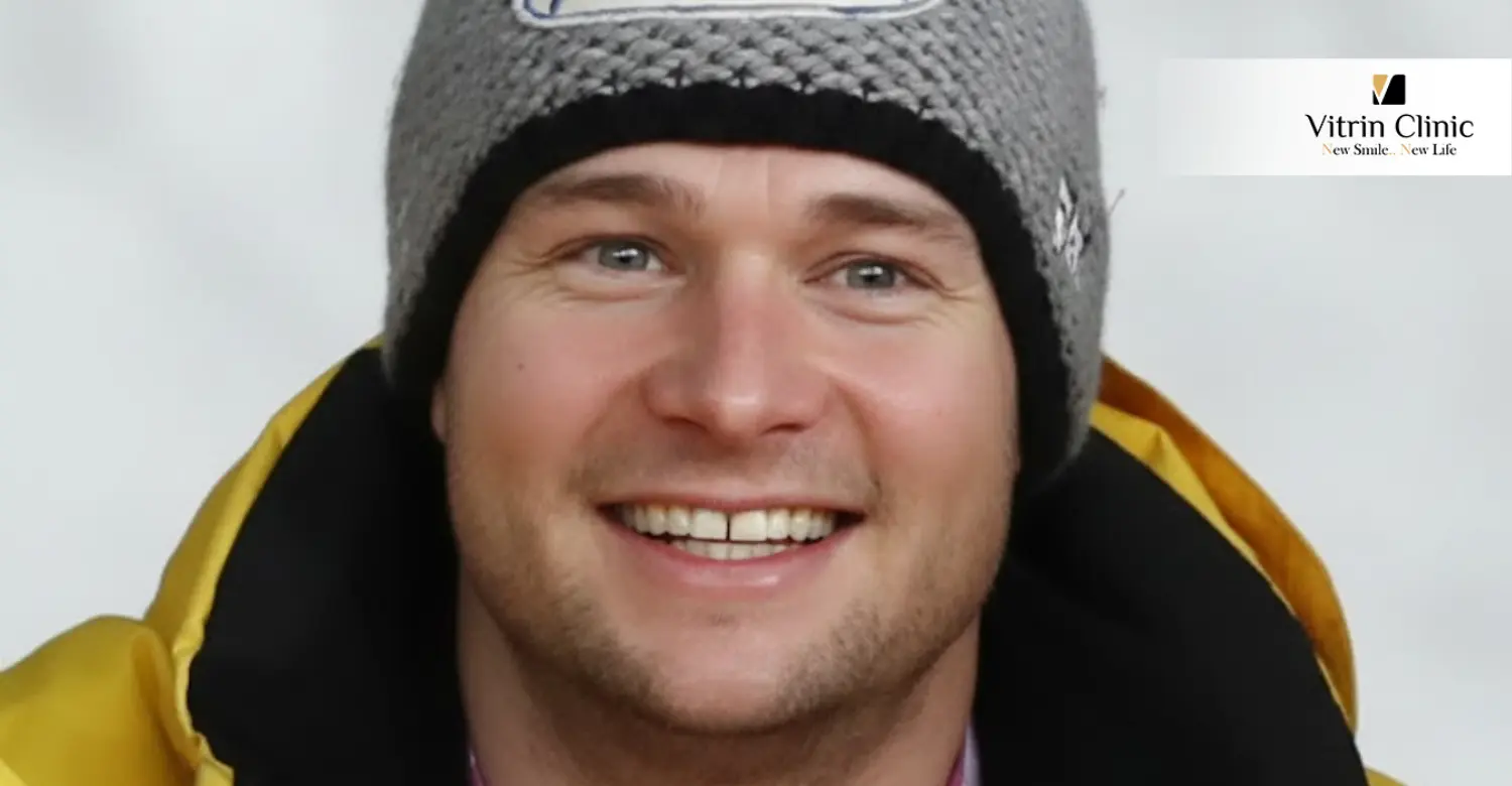 Olympische Highlights des Lächelns von Johannes Lochner