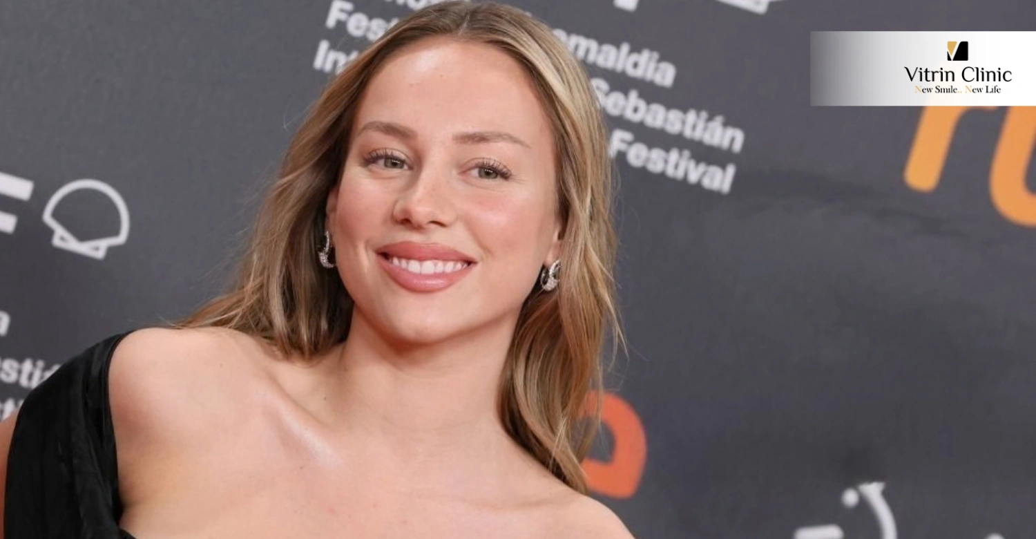 Ester Exposito Gülüşü ve Diş Estetiği