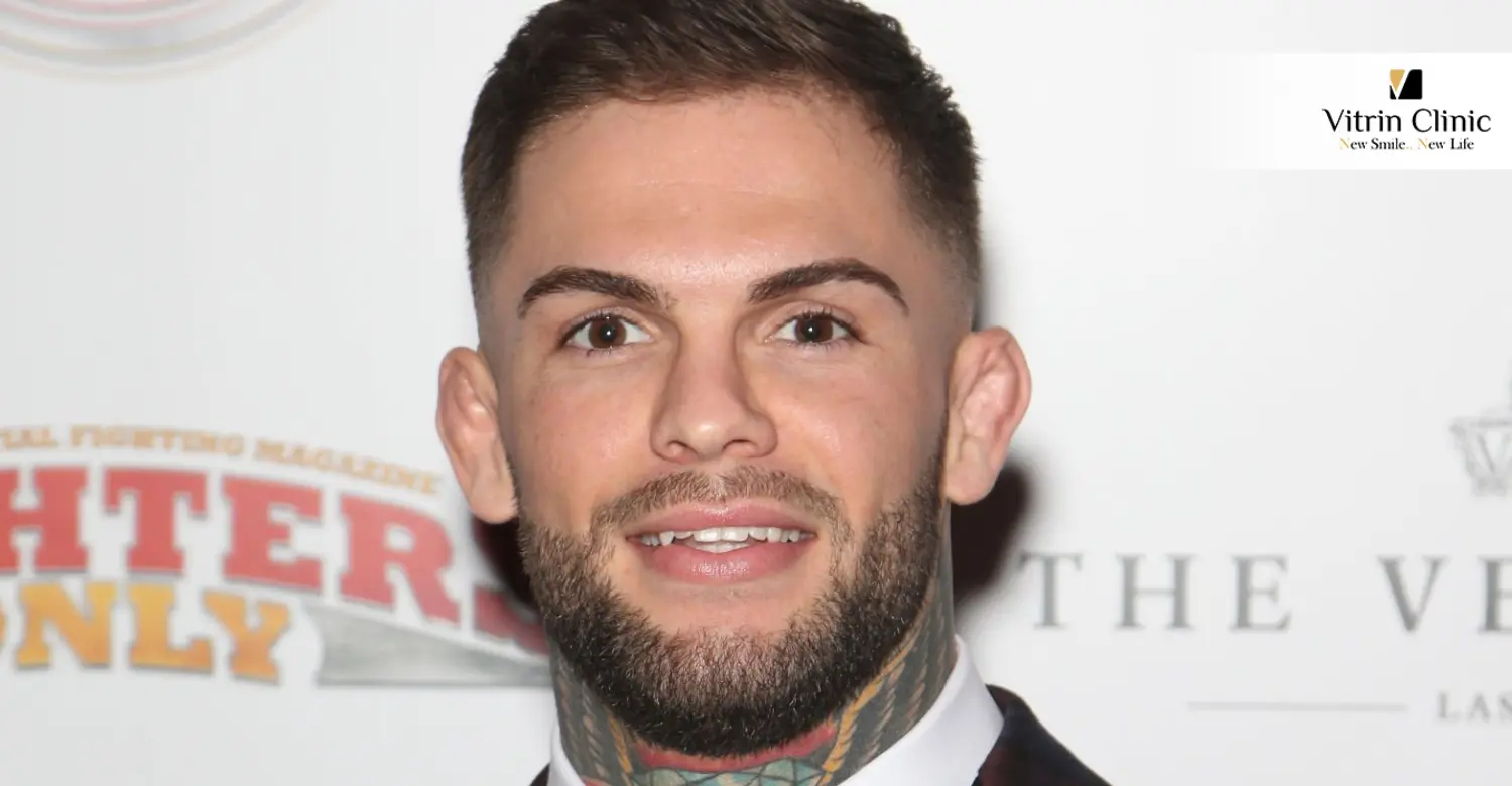 Роль стоматологических работ в уверенности профессиональных спортсменов