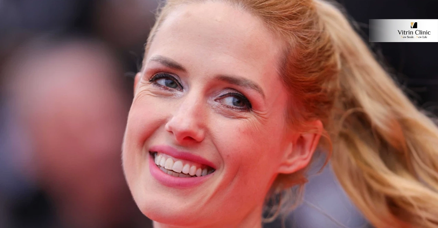 Wilma Elles Gülüşü