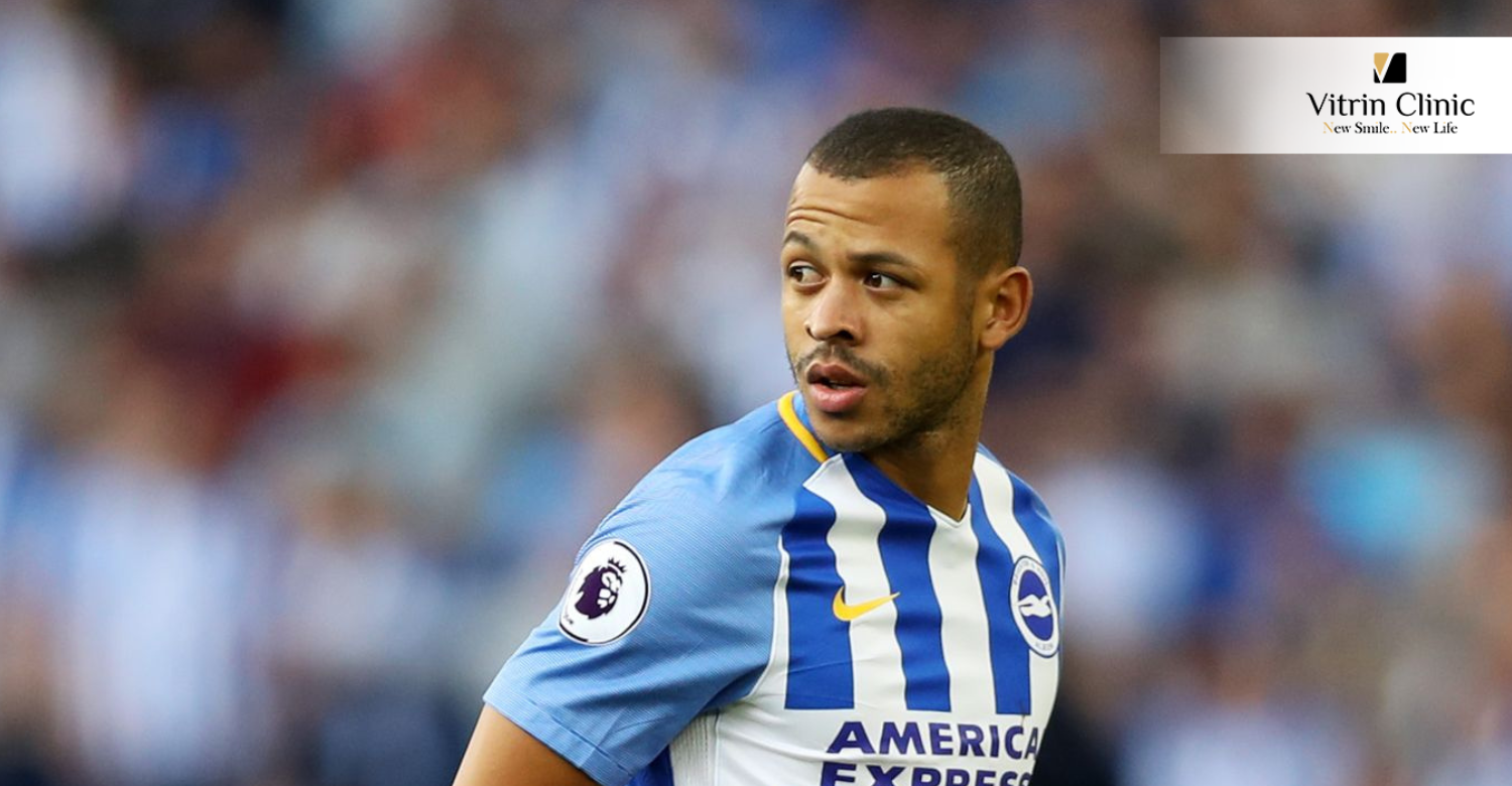 Liam Rosenior's Teeth in 2012