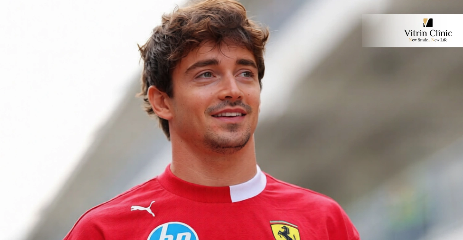Charles Leclerc Gülüşü Dişleri Öncesi ve Sonrası