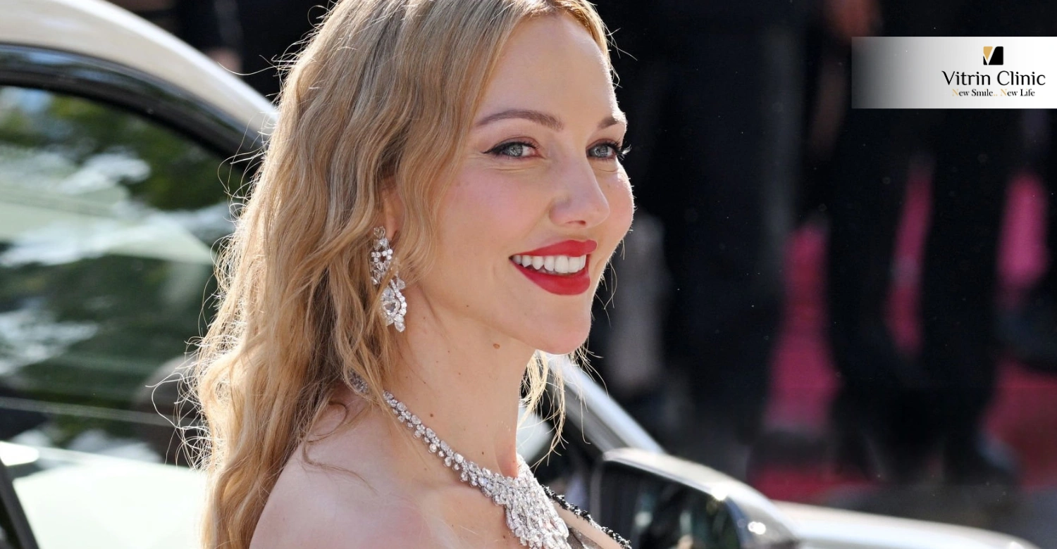 Улыбка Мерьем Узерли