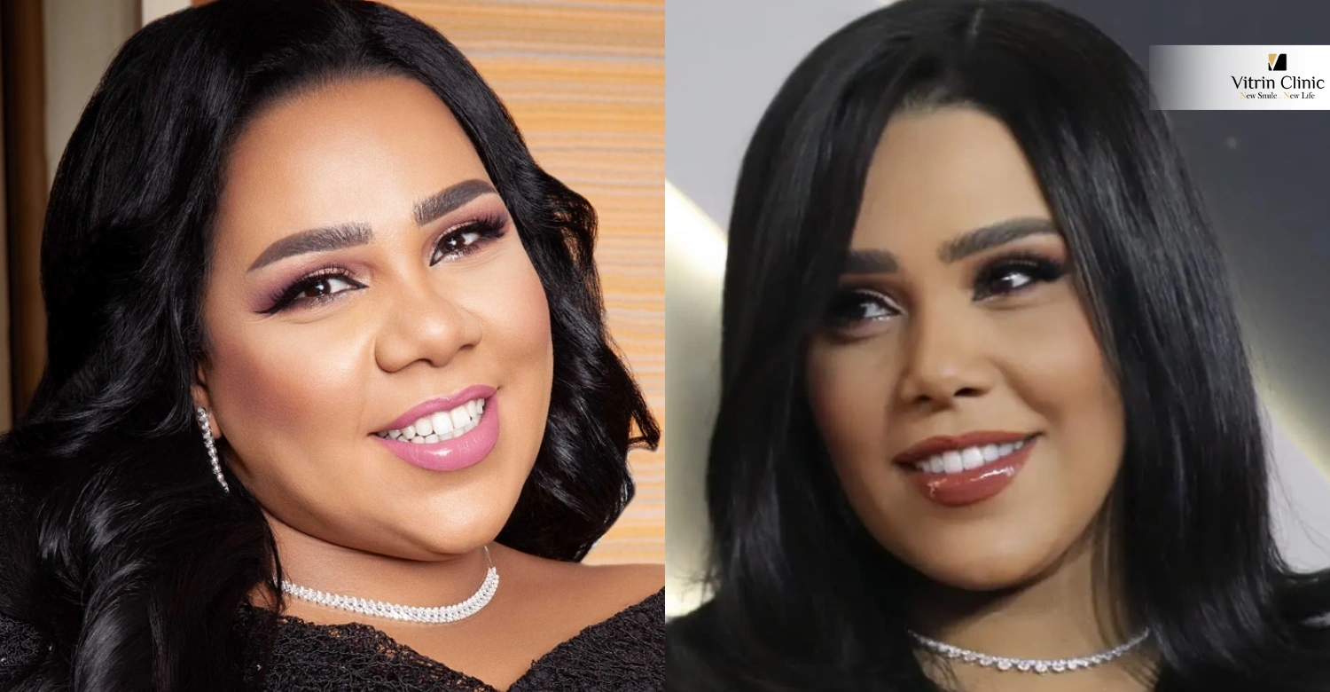 ابتسامة شيماء سيف: قبل وبعد