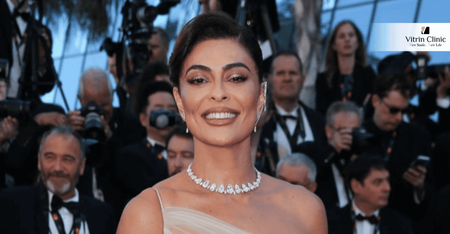 Passos para Alcançar o Sorriso da Juliana Paes