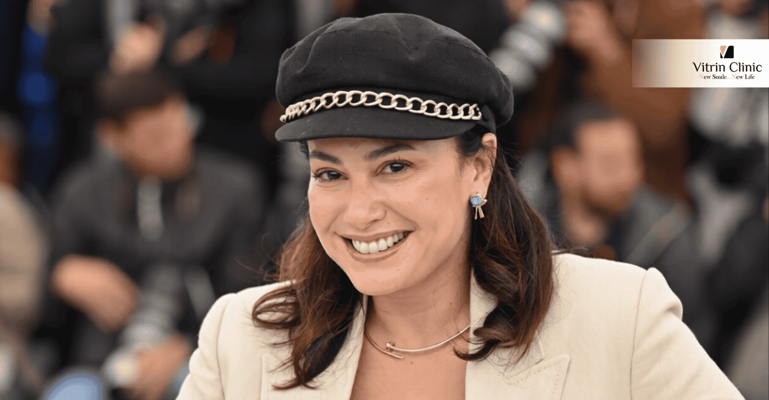 هل تمتلك هند صبري ابتسامة هوليوود؟