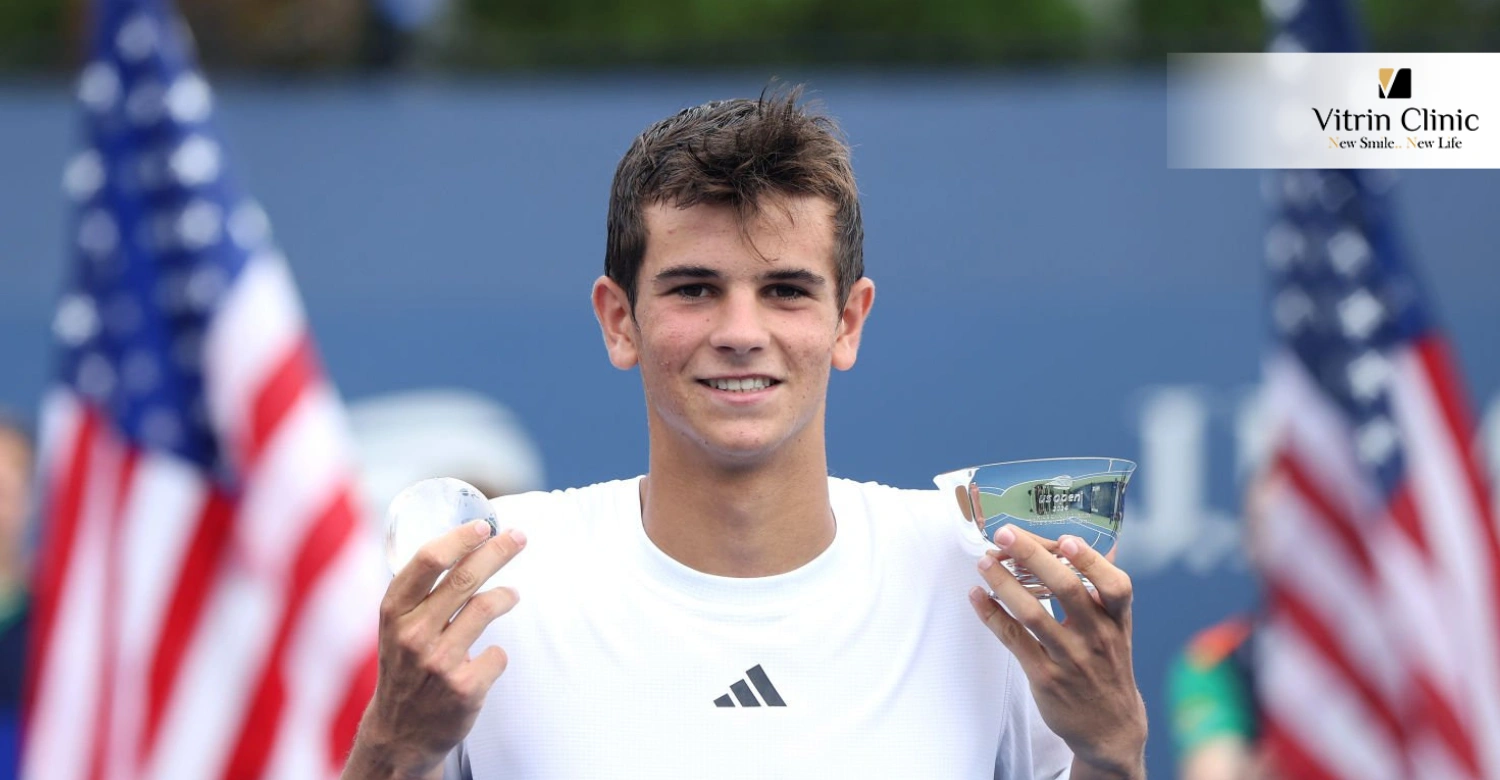 Manteniendo una Sonrisa Estilo Rafa Jodar