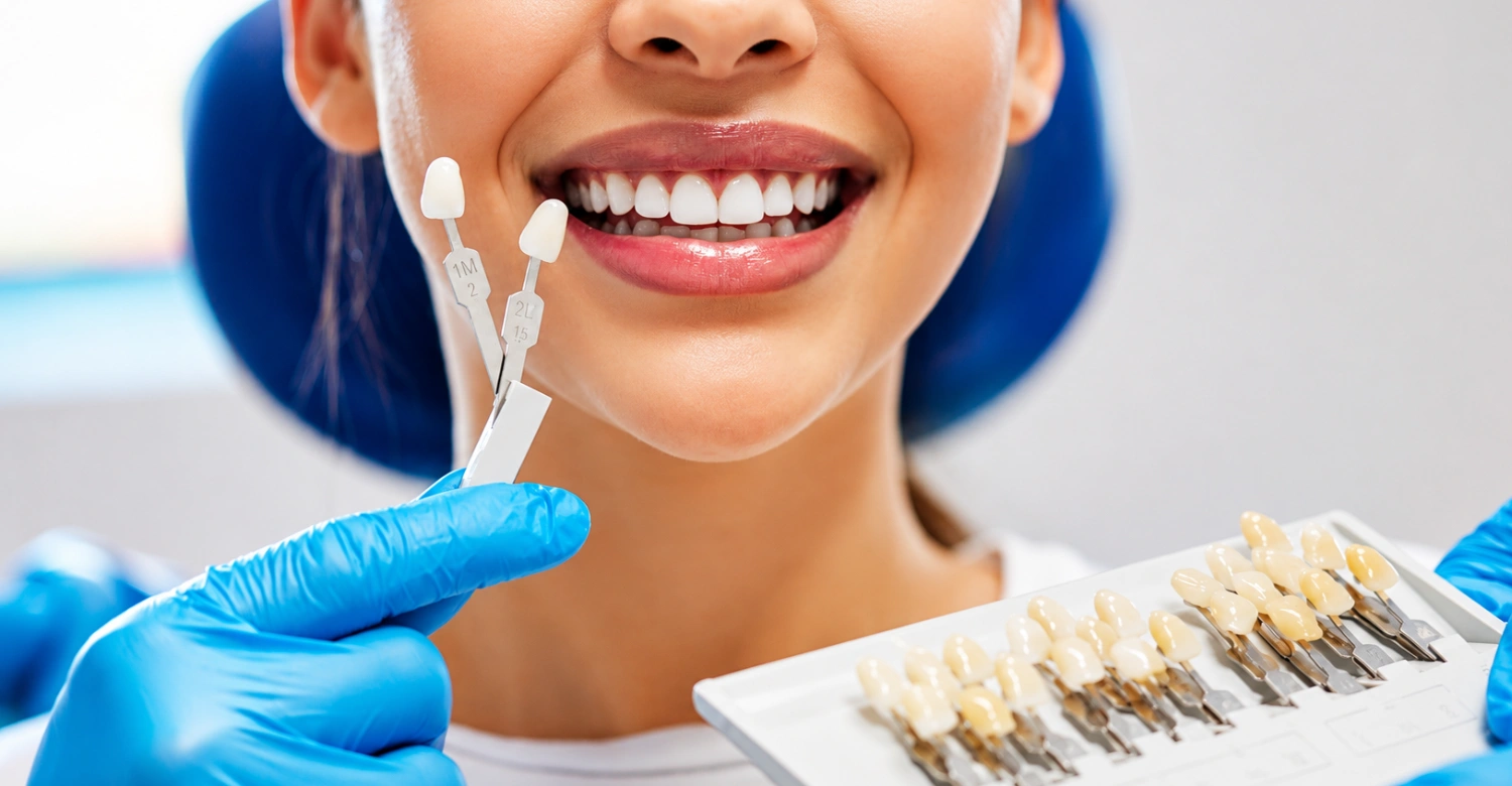 Veneers cost in the UK1
