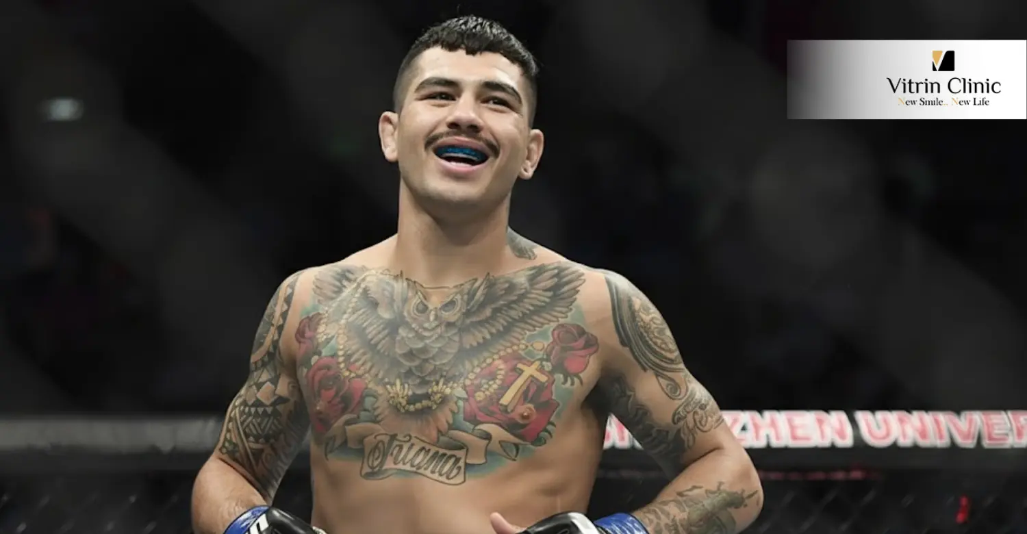 Зубы Энтони Эрнандеса: до и после