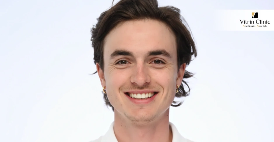 Au Cœur de la Transformation du Sourire de Marco Heinis