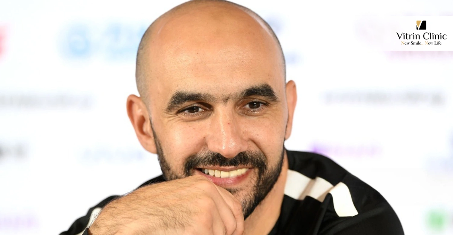 Pression de la Performance et Perception du Sourire