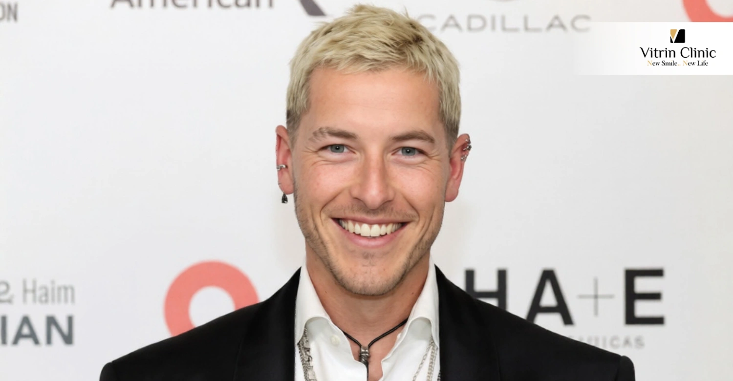 Elementos de la sonrisa de Taz Skylar