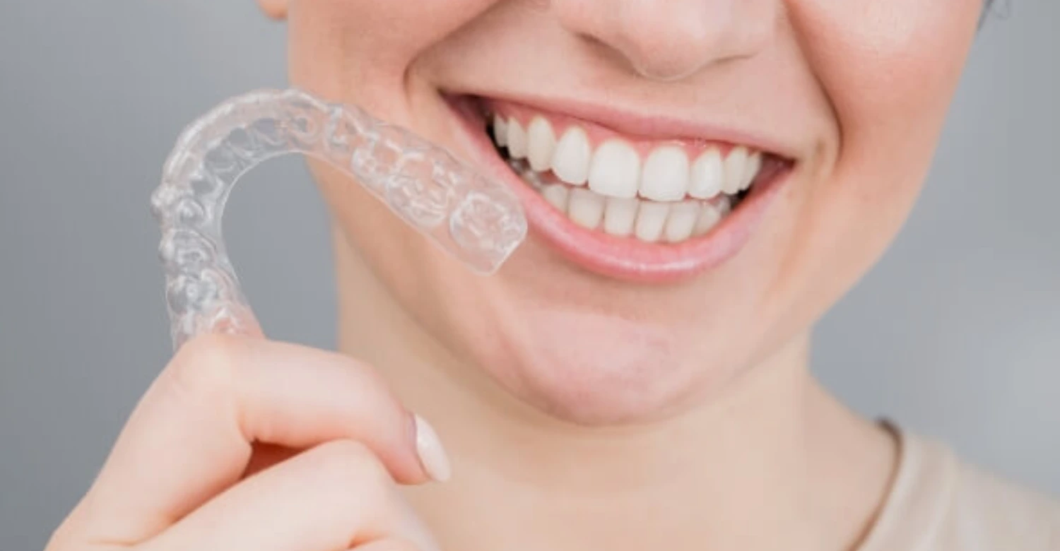 What are the different types of Invisalign? - Vitrin Clinic